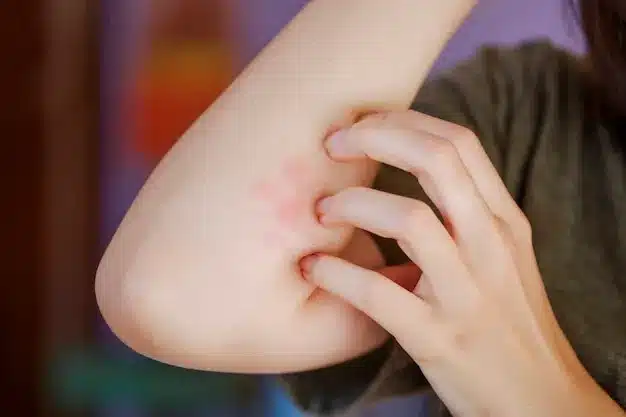 Severe Allergic Reactions