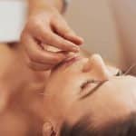 Acupuncture and Stress Reduction