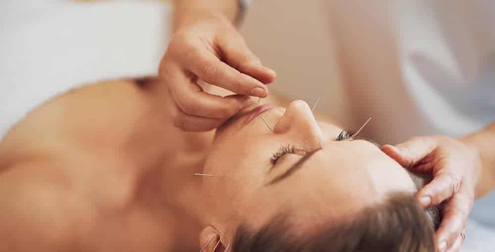 Acupuncture and Stress Reduction