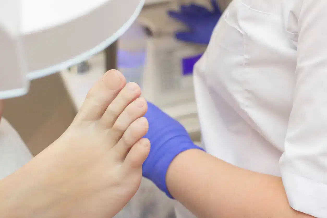 Diabetic Foot Care