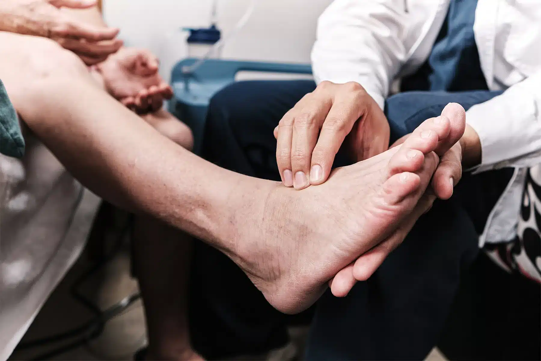 Diabetic Neuropathy