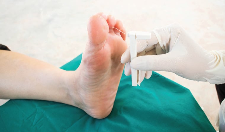 Diabetic Wound Care