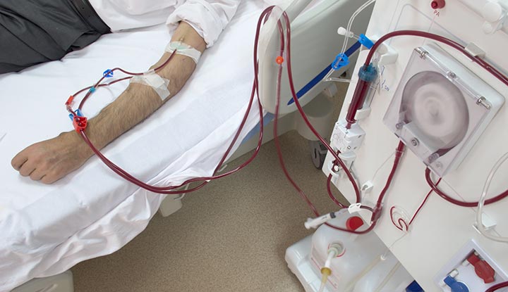 Dialysis Access Procedures