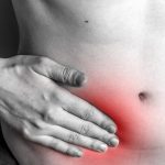 Hernia Surgery