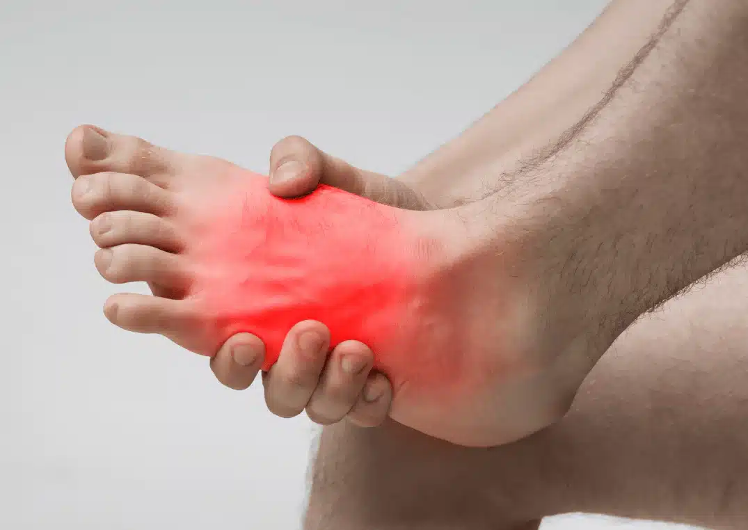 Manage Foot Pain