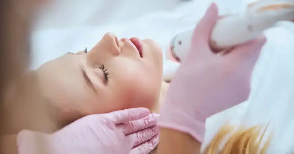 Microneedling Results