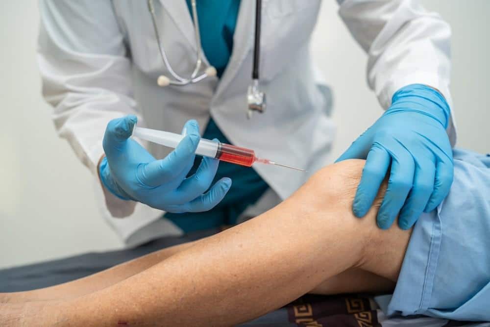 PRP Injections