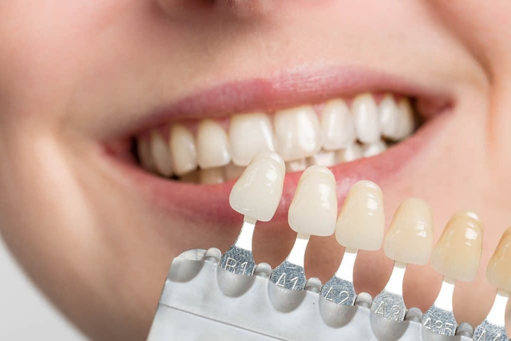 Tooth Replacement