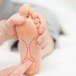 Managing Heel Pain