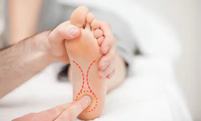 Managing Heel Pain